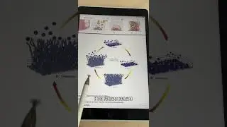Кишечник и рак / Об этом не принято много говорить, но цифры ужасают!
