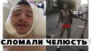 Сломали челюсть на пикап тренинге. Стал неадекватным? РЕАКЦИЯ РОДИТЕЛЕЙ.