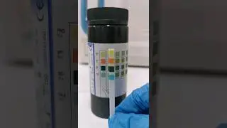 Urinalysis - Urine analysis It's normal 
