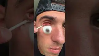 MY EYEBALL FELL OUT 😭