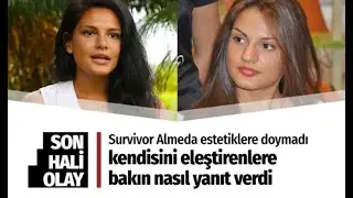 Survivor Almeda'nın inanılmaz değişimi! Estetikle bambaşka birine dönüştü