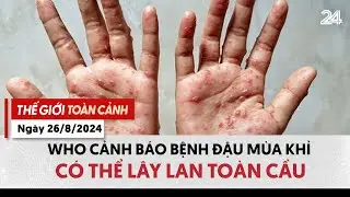 Thế giới toàn cảnh ngày 26/8: WHO cảnh báo bệnh đậu mùa khỉ có thể lây lan toàn cầu | VTV24