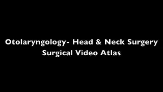 Neck Dissection: Levels I-III