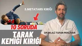 Tarak Kemiği (5. Metatars) Kırıkları Nedir? // Tarak Kemiği Kırığı Tedavisi Nasıl Yapılır?