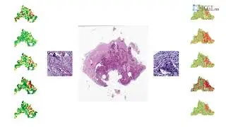 Histotyping. Pathology AI software