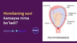 Homila suni kamaysa homilaga nima bo'ladi