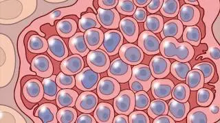 Parasite-Derived Cancer