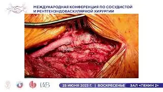 Как я это делаю 25.06.23 Конференция по сосудистой и рентгенэндоваскулярной хирургии в Мосвке