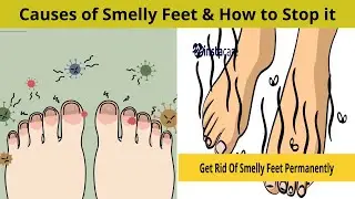 Causes of Smelly Feet How to Stop it | Nuse Healthy