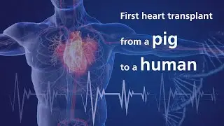 First heart transplant from a pig to a human