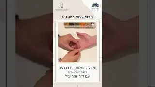 טיפול סו-ג'וק להתכווצויות ברגליים עם דר' זוהר יגיל