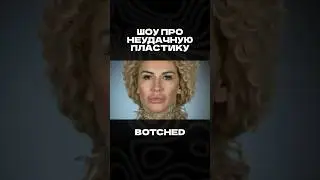 Шоу про неудачную пластику 😱