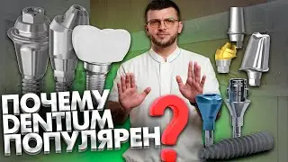 Почему детальные имплантаты Dentium очень популярны?