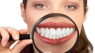 Тишларни уй шароитида Қандай Оқартирамиз