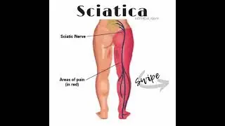 Sciatica easy action workout at home #YogaHealthFitness