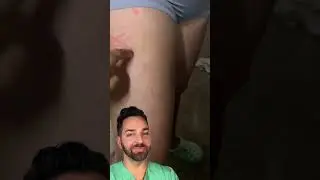 What iss thattttt? Doctorly Explains Dermatographia #shorts