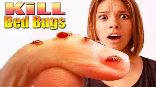 How to Get Rid of Bed Bugs Naturally Without Chemicals