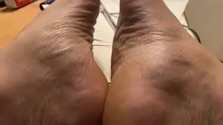 Foot fasciculations — muscles twitching