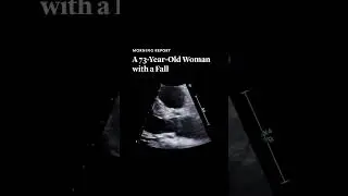 A 73-Year-Old Woman with a Fall (Video 1) | NEJM Evidence 
