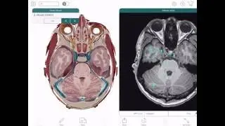 Human Anatomy Atlas 2017 Edition for iPad & Android Tablet - Overview