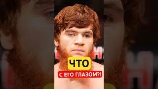 Что с Глазом Шары Буллета?! 