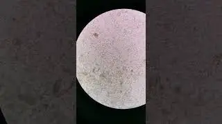 FECALYSIS STOOL ANALYSIS Poops under the microscope