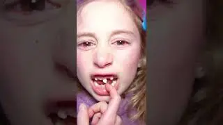 Giorgia ha paura di staccarsi il dente da sola e Papà Salvo l'aiuta! 
