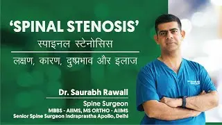 स्पाइनल स्टेनोसिस (Spinal Stenosis) - लक्षण, कारण, दुष्प्रभाव और इलाज | Dr. Saurabh Rawall