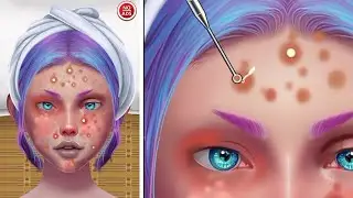 ASMR | Menghilangkan Jerawat Nanah | Makeover Makeup