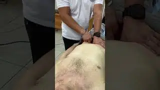 Способ обдавливания живота
